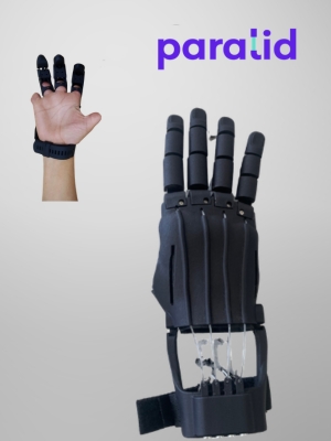 Transmetacarpal